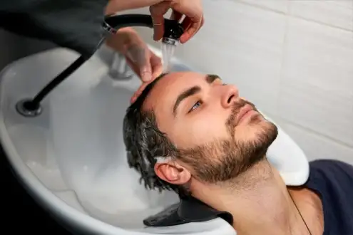▷ Hair Transplant Recovery Process | After Hair Transplant