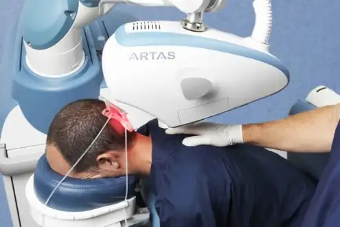 ▷ What is Robotic Hair Transplantation? | Cost 2022