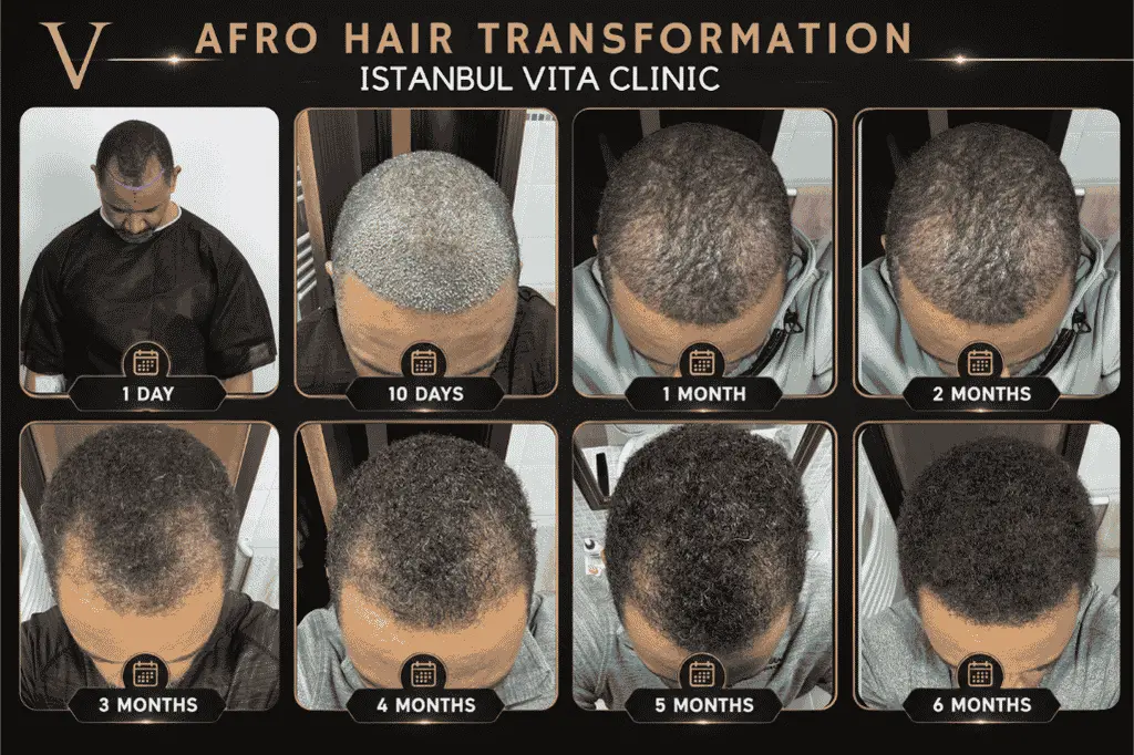 Afro hair transformation