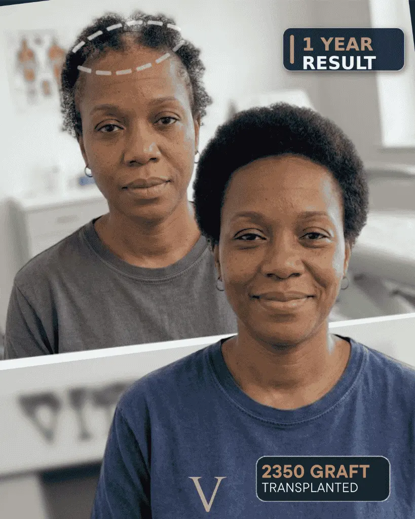 Afro hair before after