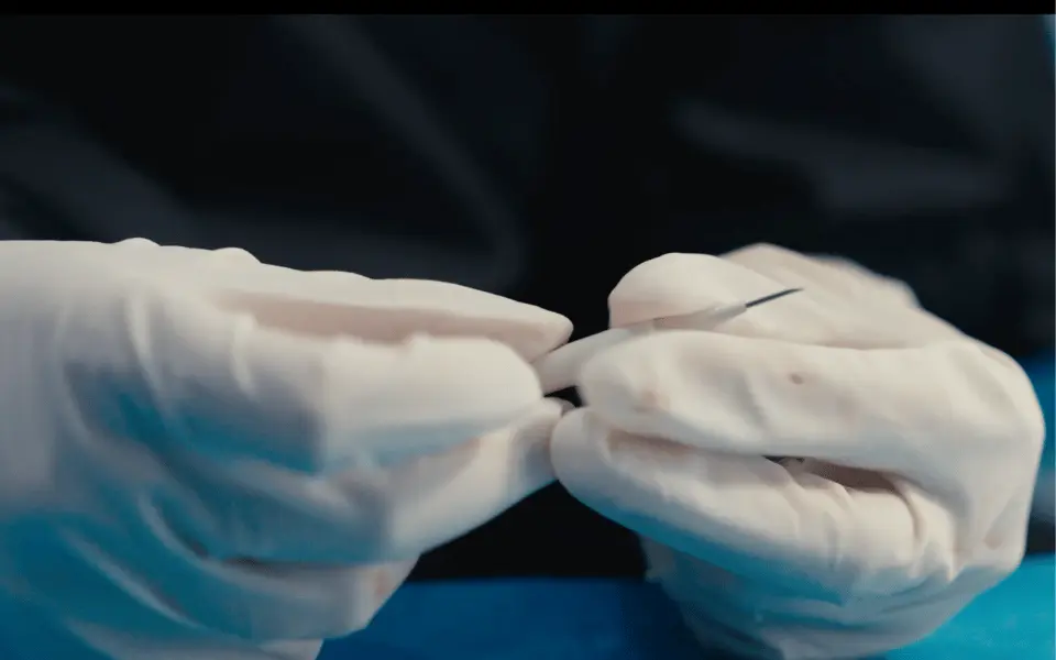Dokter die een Choi implanter pen vasthoudt tijdens een DHI haartransplantatieprocedure.