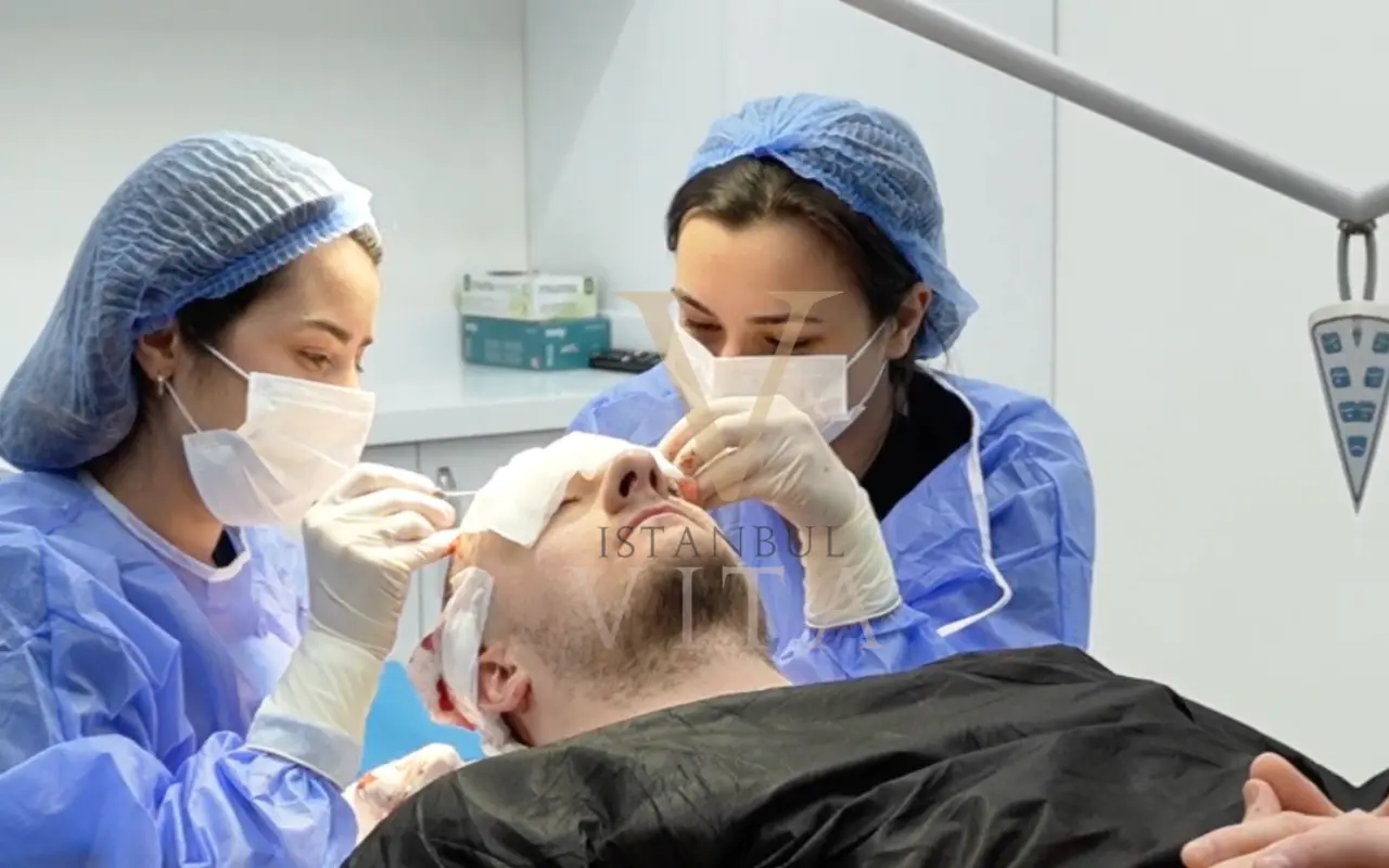 İki doktor Safir FUE saç ekimi gerçekleştiriyor